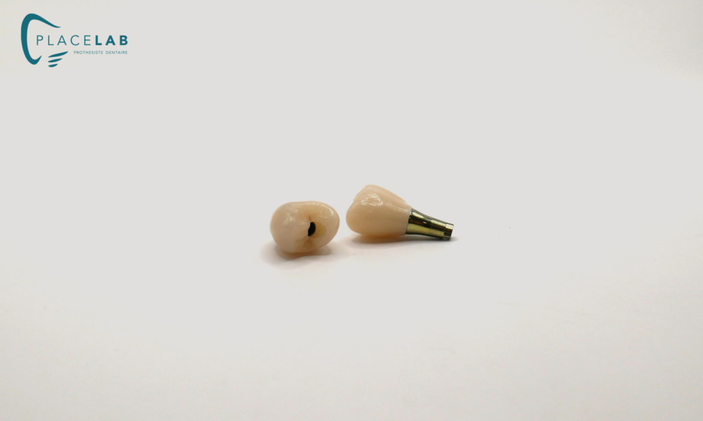 IMPLANT_EMAX_TRANSIVISE_02