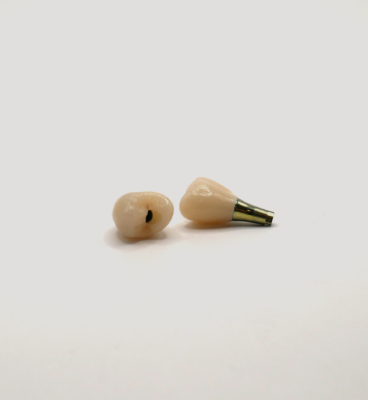IMPLANT_EMAX_TRANSIVISE_02