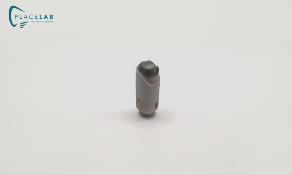 INLAY_CORE_METAL_04