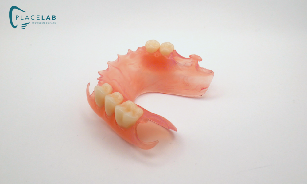 VALPLAST_01