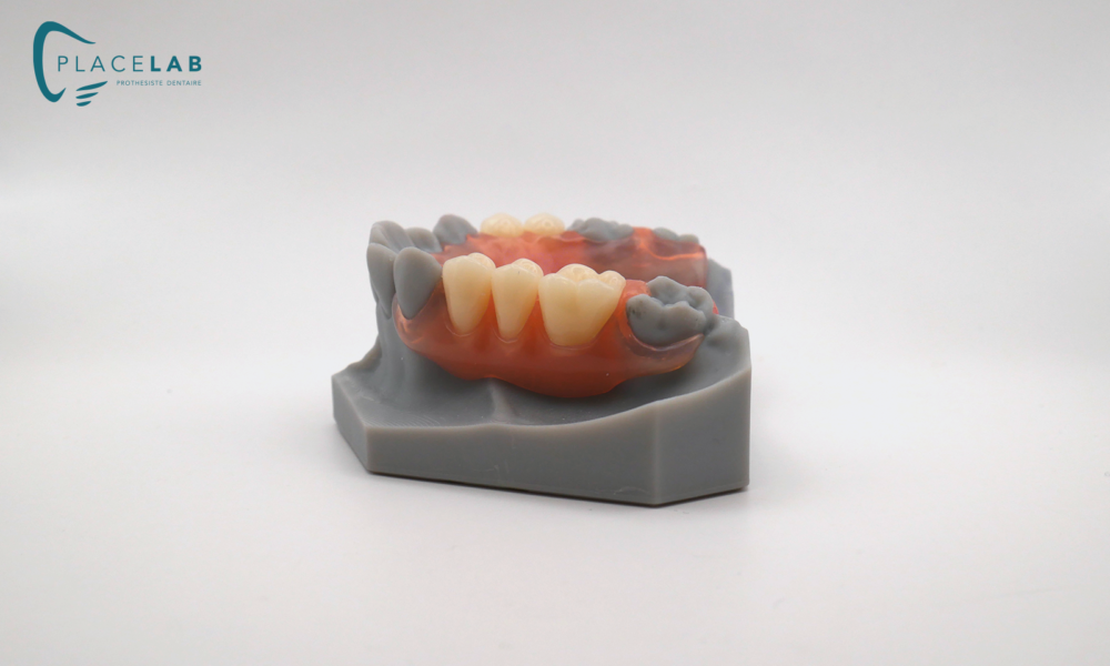 VALPLAST_03