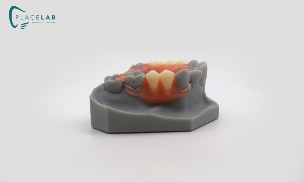 VALPLAST_04