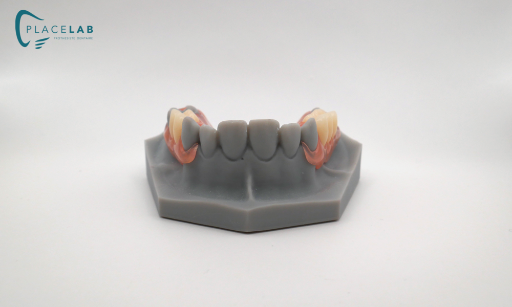 VALPLAST_05