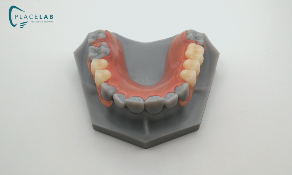 VALPLAST_06